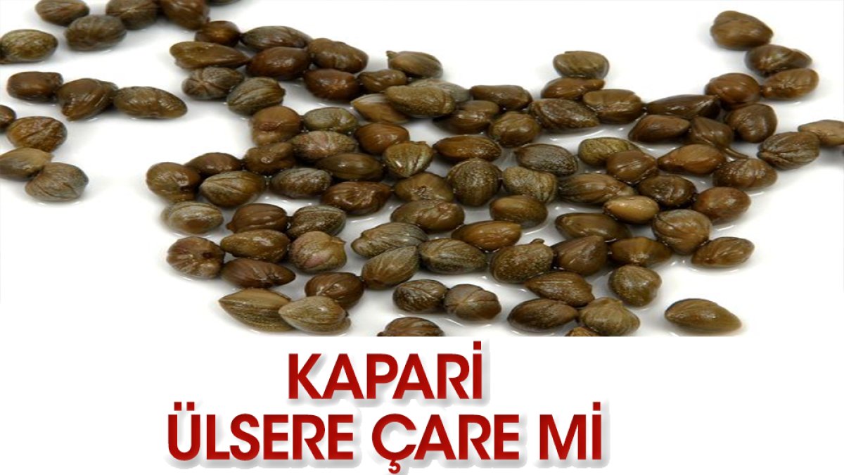 Kapari ülsere çare mi