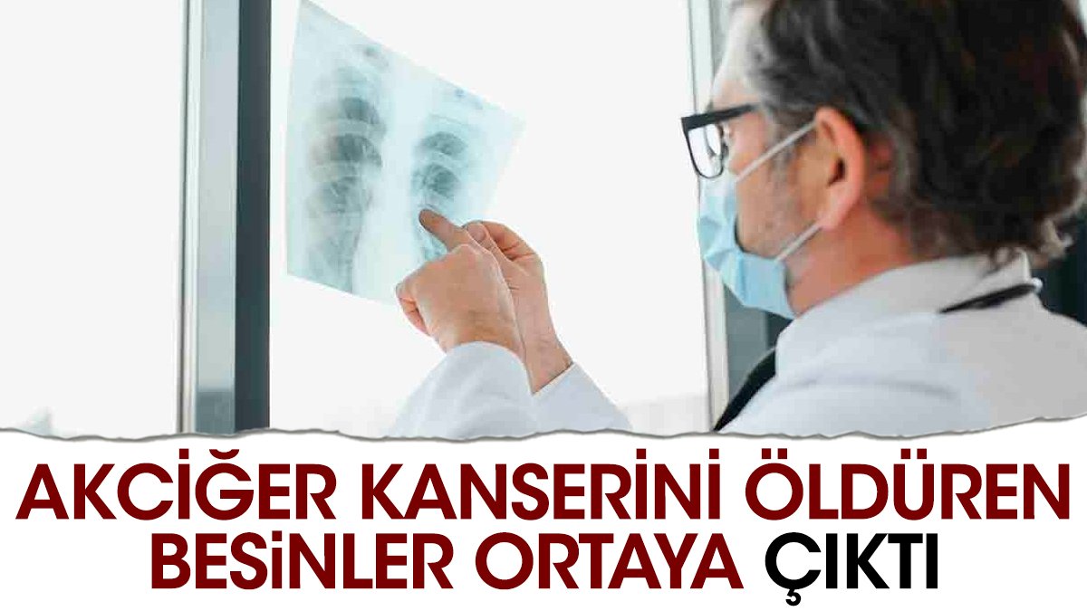 Akciğer kanserini öldüren besinler ortaya çıktı