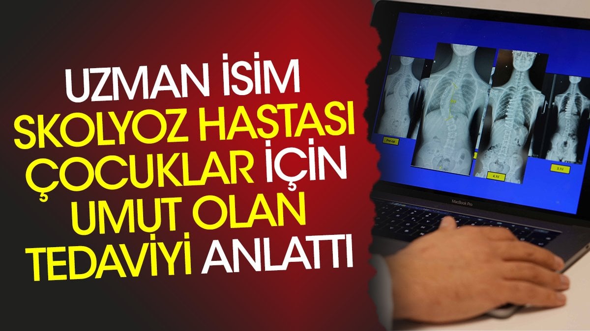 Uzman isim skolyoz hastası çocuklar için umut olan tedaviyi anlattı