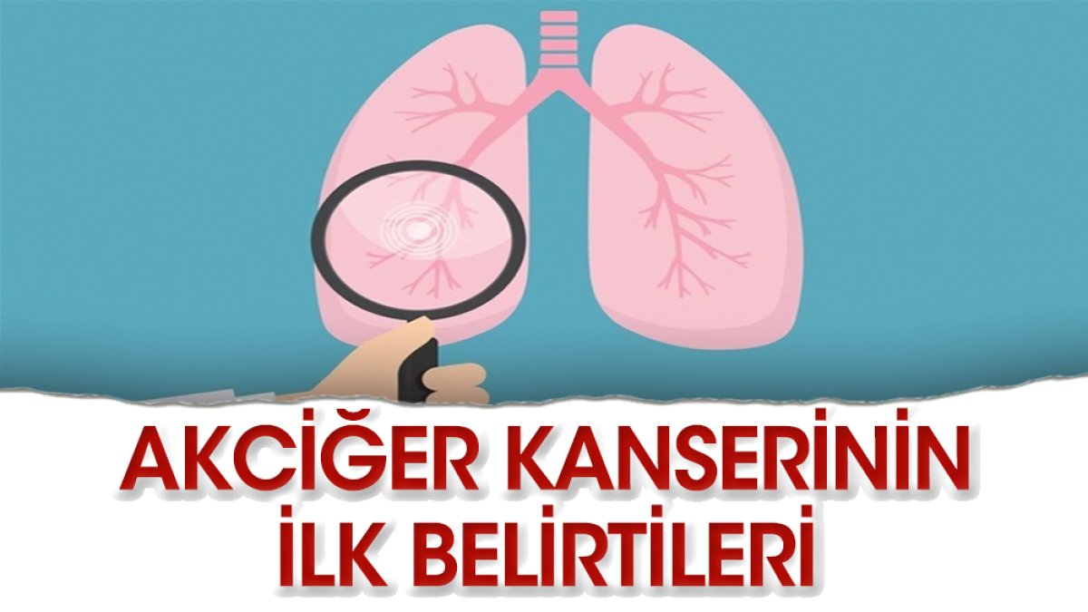 İşte Akciğer Kanserinin ilk belirtileri