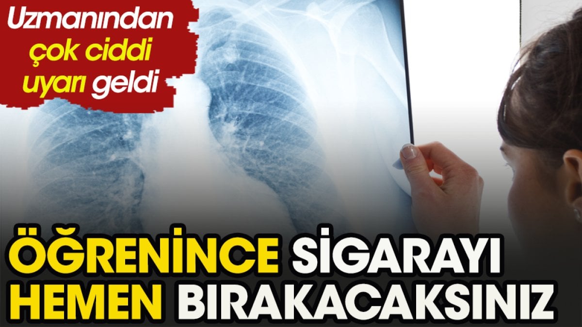 Uzmanı çok ciddi uyardı öğrenince sigarayı hemen bırakacaksınız