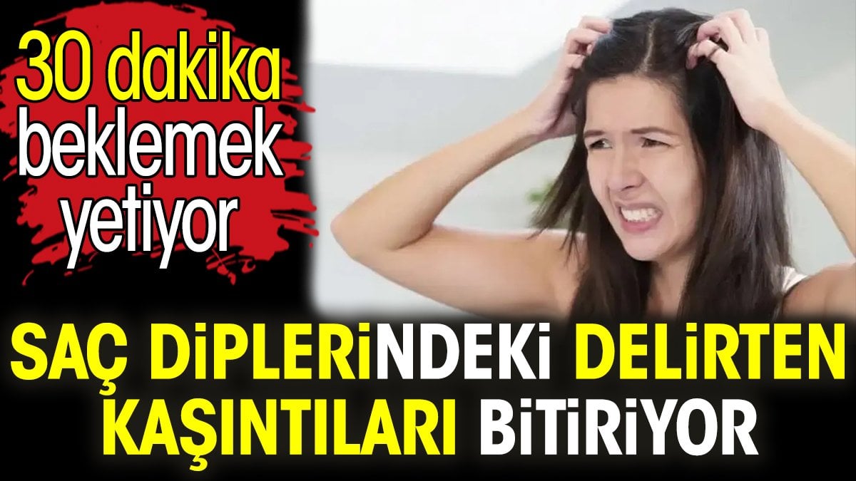 Saç diplerindeki delirten kaşıntıları bitiriyor. 30 dakika beklemek yetiyor