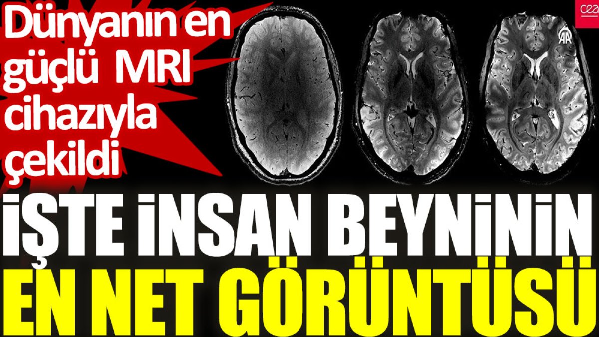 Dünyanın en güçlü MRI cihazıyla çekildi. İşte insan beyninin en net görüntüsü