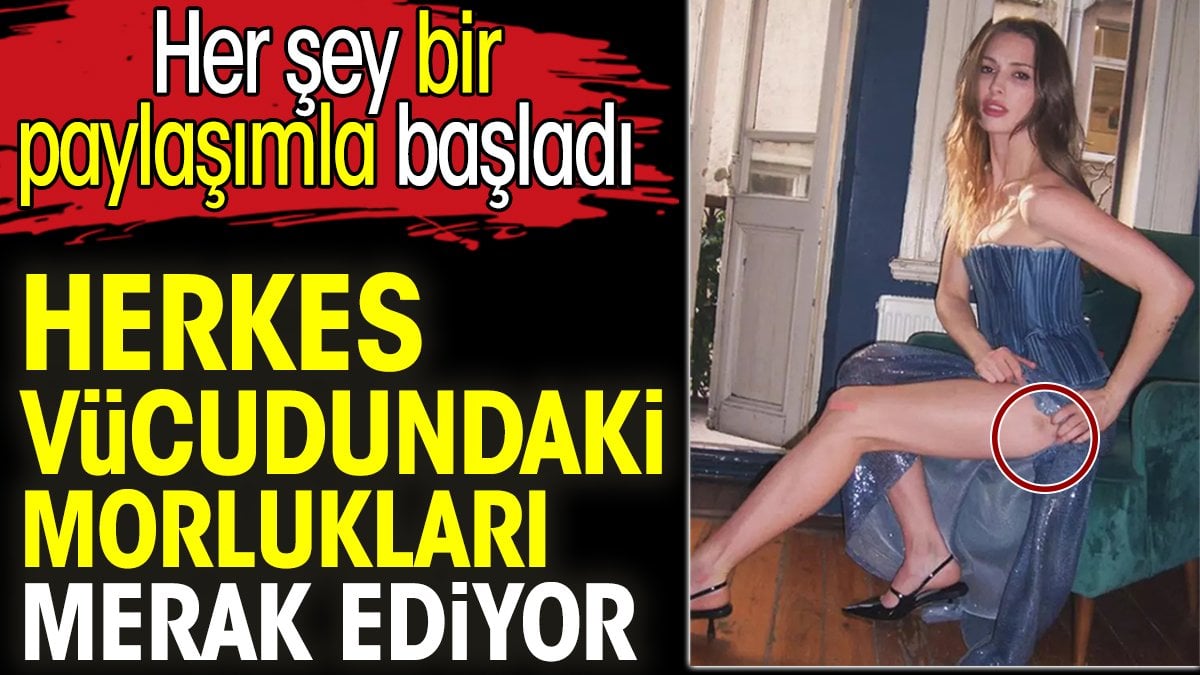 Yasemin Allen'in vücudundaki morluklar merak ediliyor. Her şey bir paylaşımla başladı