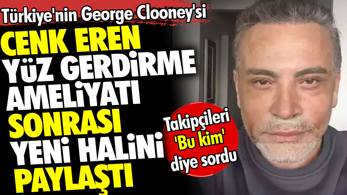 Türkiye'nin George Clooney'si Cenk Eren yüz gerdirme ameliyatı sonrası yeni halini paylaştı. Takipçileri 'Bu kim' diye sordu