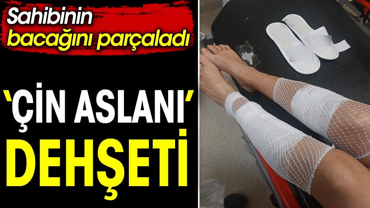 ‘Çin Aslanı’ dehşeti. Sahibinin bacağını parçaladı