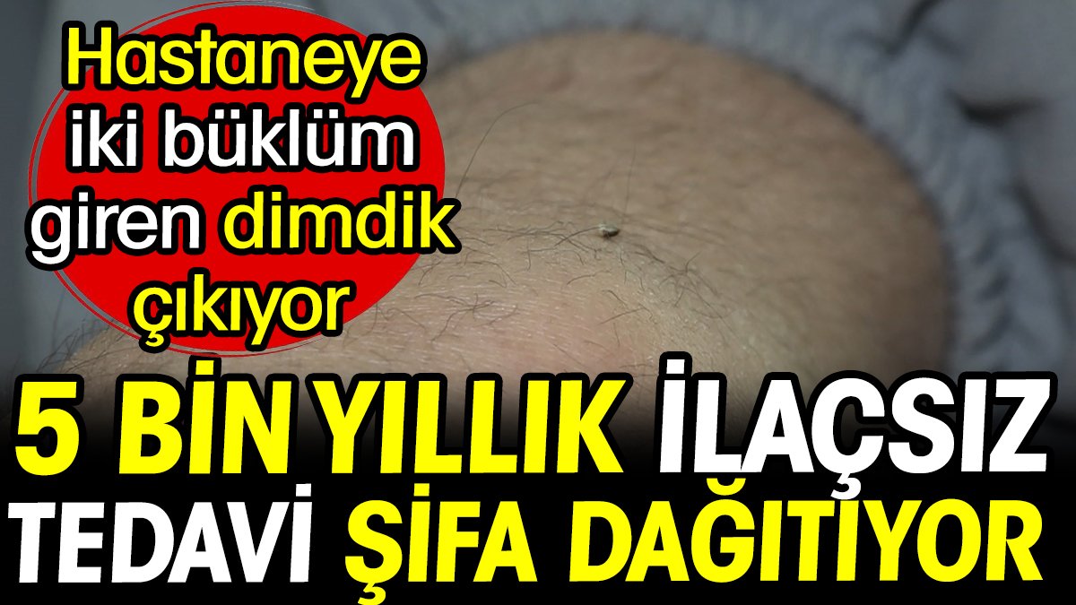 5 bin yıllık ilaçsız tedavi şifa dağıtıyor! Hastaneye iki büklüm giren dimdik çıkıyor