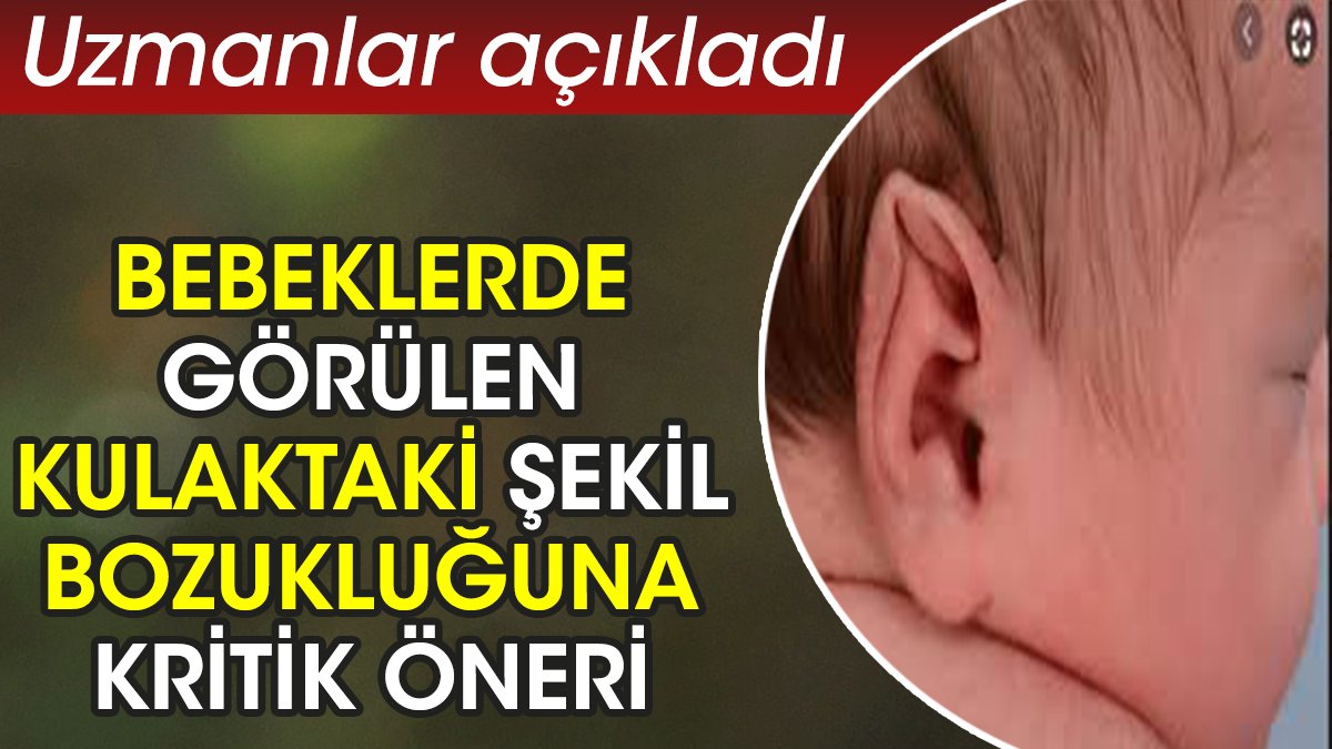 Bebeklerde görülen kulaktaki şekil bozukluğuna kritik öneri. Uzmanlar açıkladı
