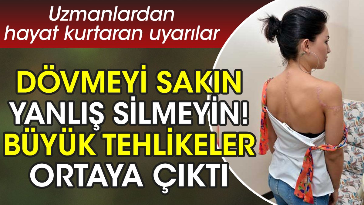 Dövmeyi sakın yanlış silmeyin! Büyük tehlikeler ortaya çıktı. Uzmanlardan hayat kurtaran uyarılar