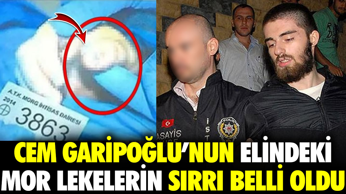 Cem Garipoğlu’nun elindeki mor lekelerin sırrı belli oldu