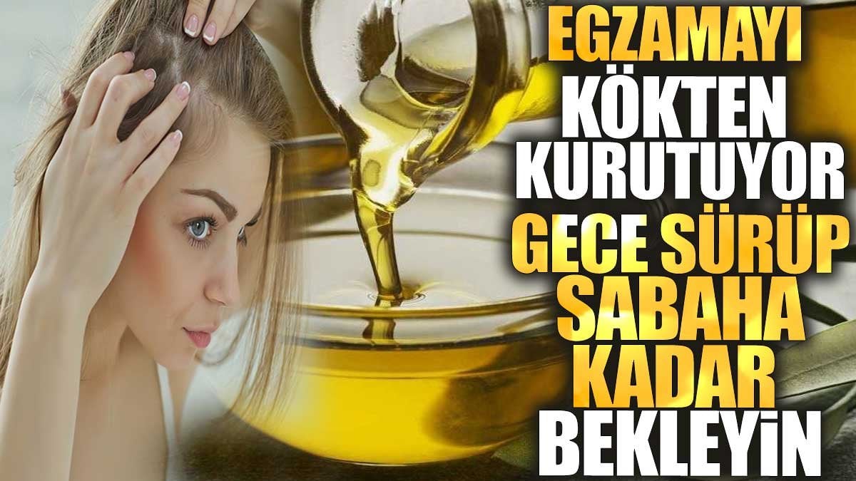 Egzamayı kökten kurutuyor! Gece sürüp sabaha kadar bekleyin