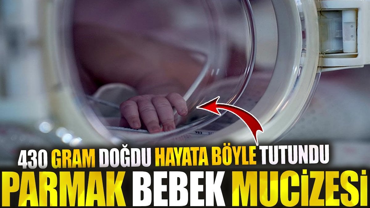 Parmak Bebek mucizesi! 430 gram doğdu hayata böyle tutundu