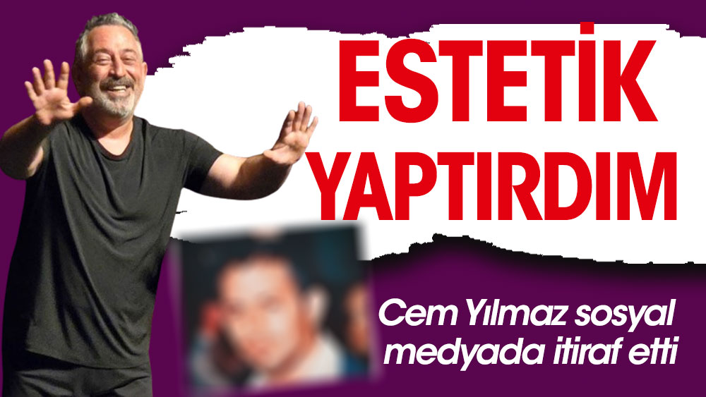 Cem Yılmaz estetik yaptırdı