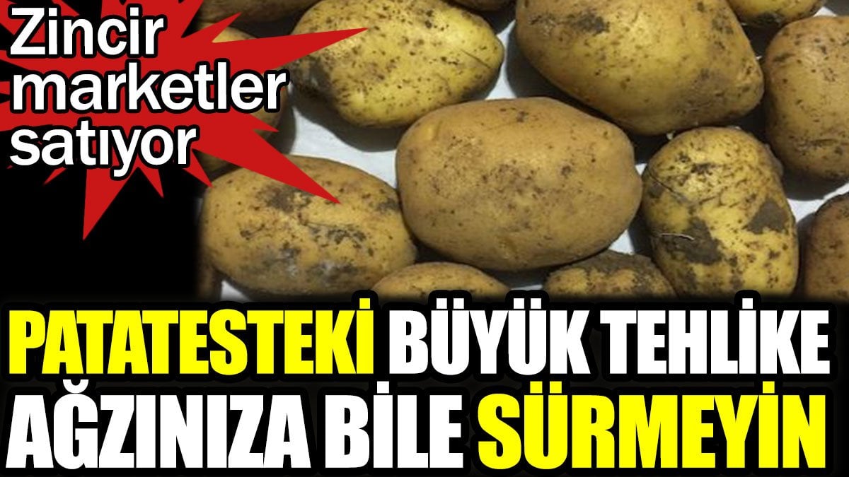 Patatesteki büyük tehlike ağzınıza bile sürmeyin. Zincir marketlerde satılıyor