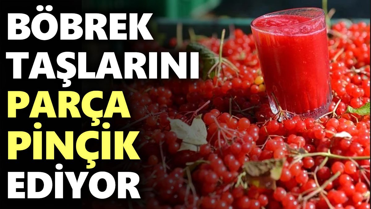 Böbrek taşlarını parça pinçik ediyor