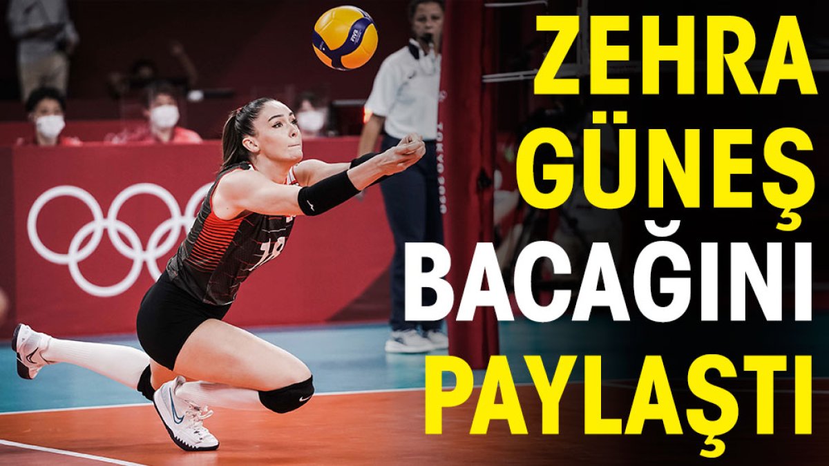 Zehra Güneş bacağını paylaştı