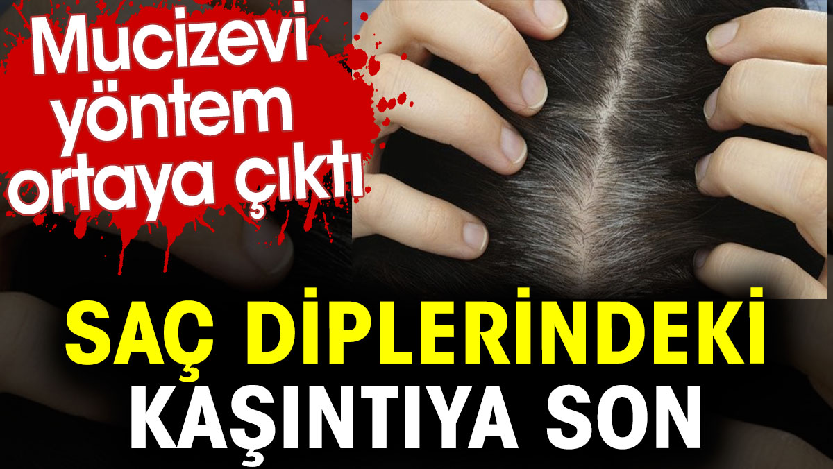 Saç diplerindeki kaşıntıya son. Mucizevi yöntem ortaya çıktı