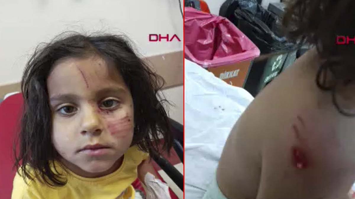 Şanlıurfa'da 4 yaşındaki çocuğa sokak köpekleri saldırdı