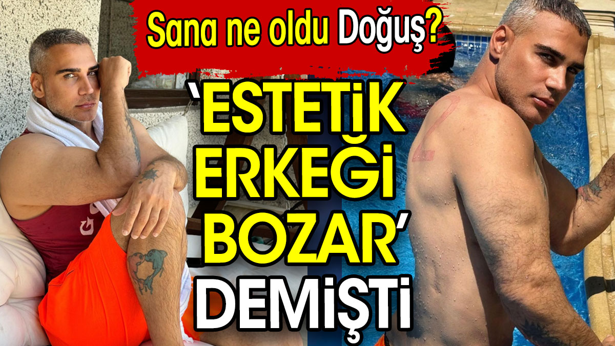 Şarkıcı Doğuş’a bir haller olmuş! ‘Estetik erkeği bozar’ demişti