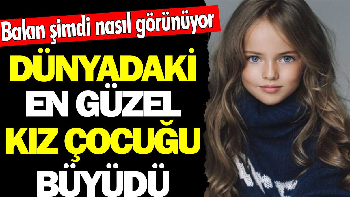 Dünyadaki en güzel kız çocuğu büyüdü. Bakın şimdi nasıl görünüyor