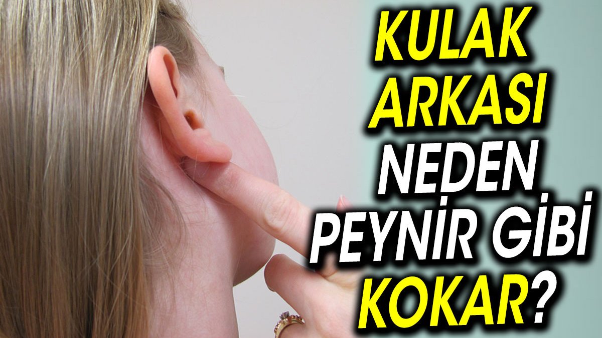 Kulak arkası neden peynir gibi kokar?