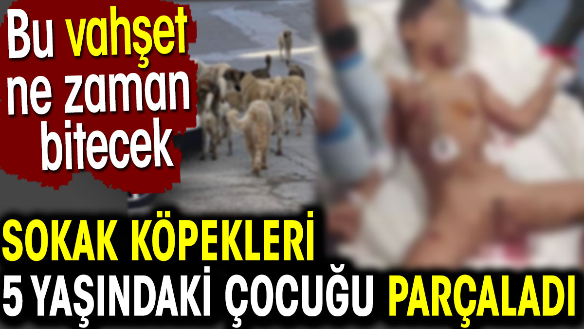 Sokak köpekleri 5 yaşındaki çocuğu parçaladı. Bu tehlike ne zaman bitecek