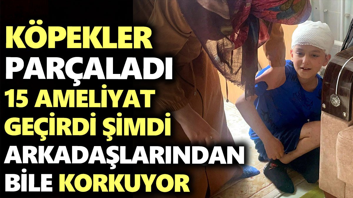 Sokak köpekleri parçaladı 15 ameliyat geçirdi şimdi arkadaşlarından bile korkuyor