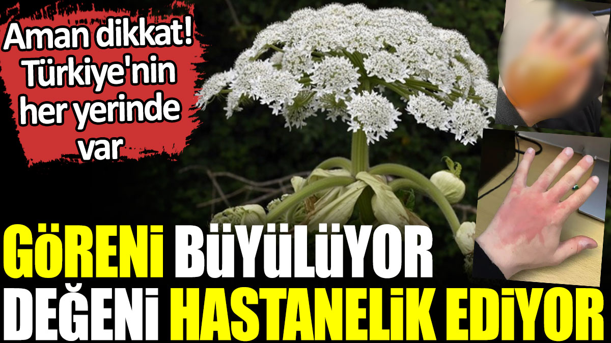 Göreni büyülüyor değeni hastanelik ediyor. Aman dikkat! Türkiye'nin her yerinde var