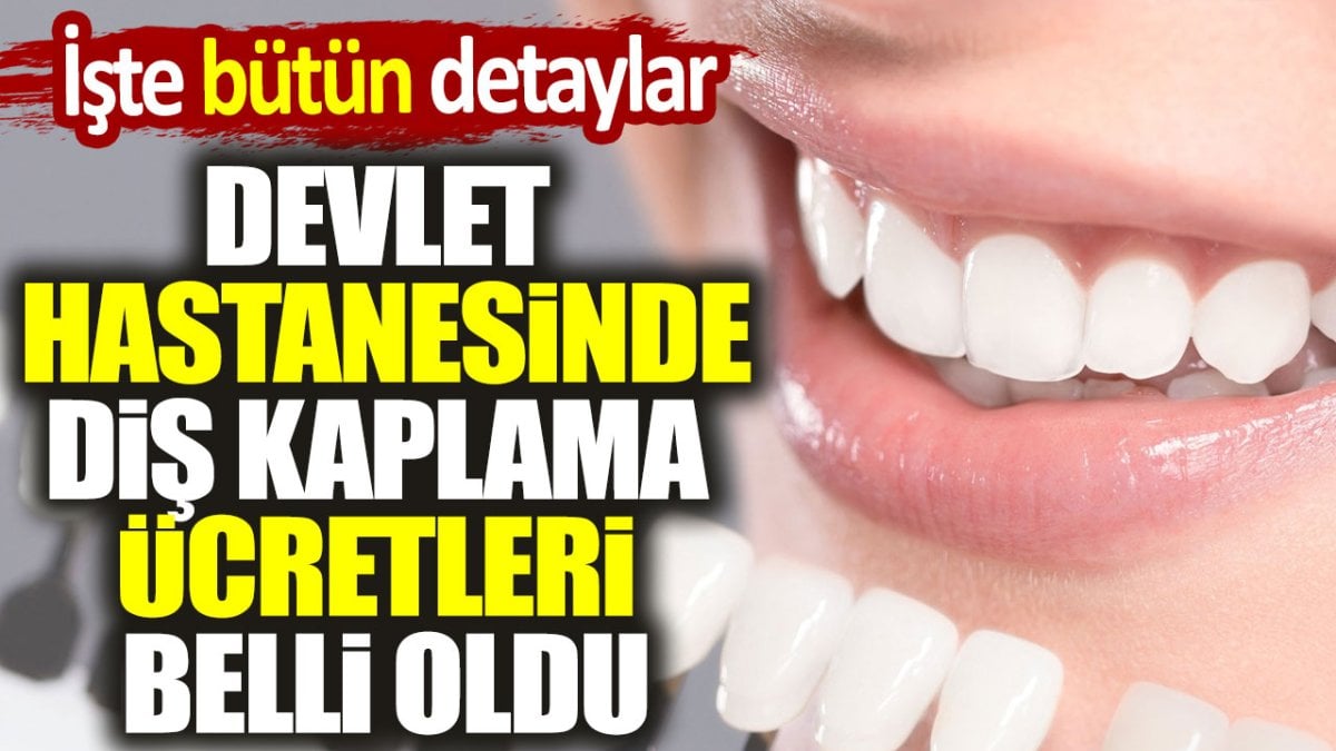 Devlet hastanesinde diş kaplama ücretleri ne kadar?