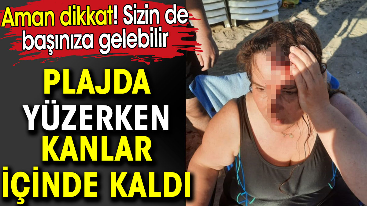 Plajda yüzerken kanlar içinde kaldı. Sizin de başınıza gelebilir