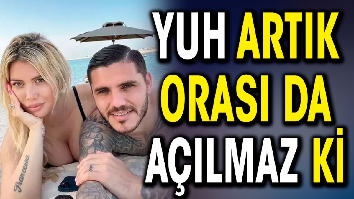 Yuh artık. Orası da açılmaz ki