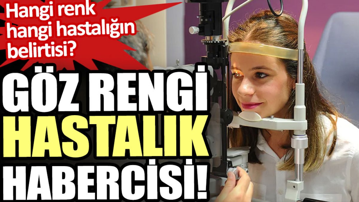 Göz renginin hastalık habercisi olduğu ortaya çıktı