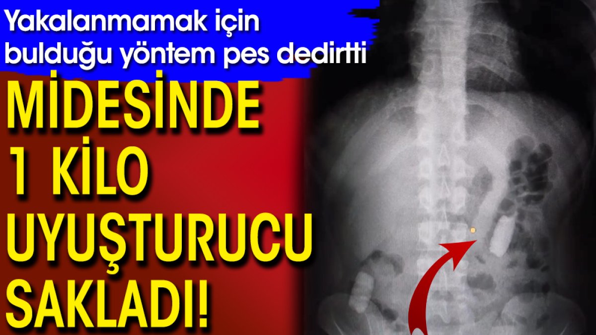 Midesinde 1 kilo uyuşturucu sakladı! Yakalanmamak için bulduğu yöntem pes dedirtti