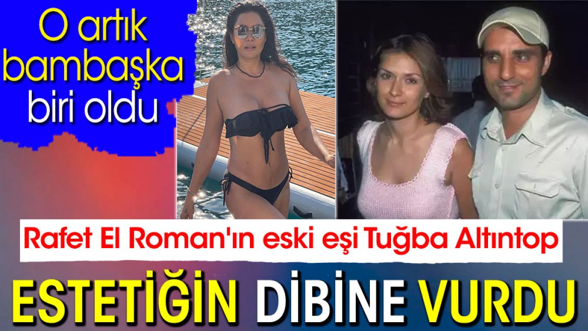 Rafet El Roman'ın eski eşi Tuğba Altıntop estetiğin dibine vurdu. O artık bambaşka biri oldu