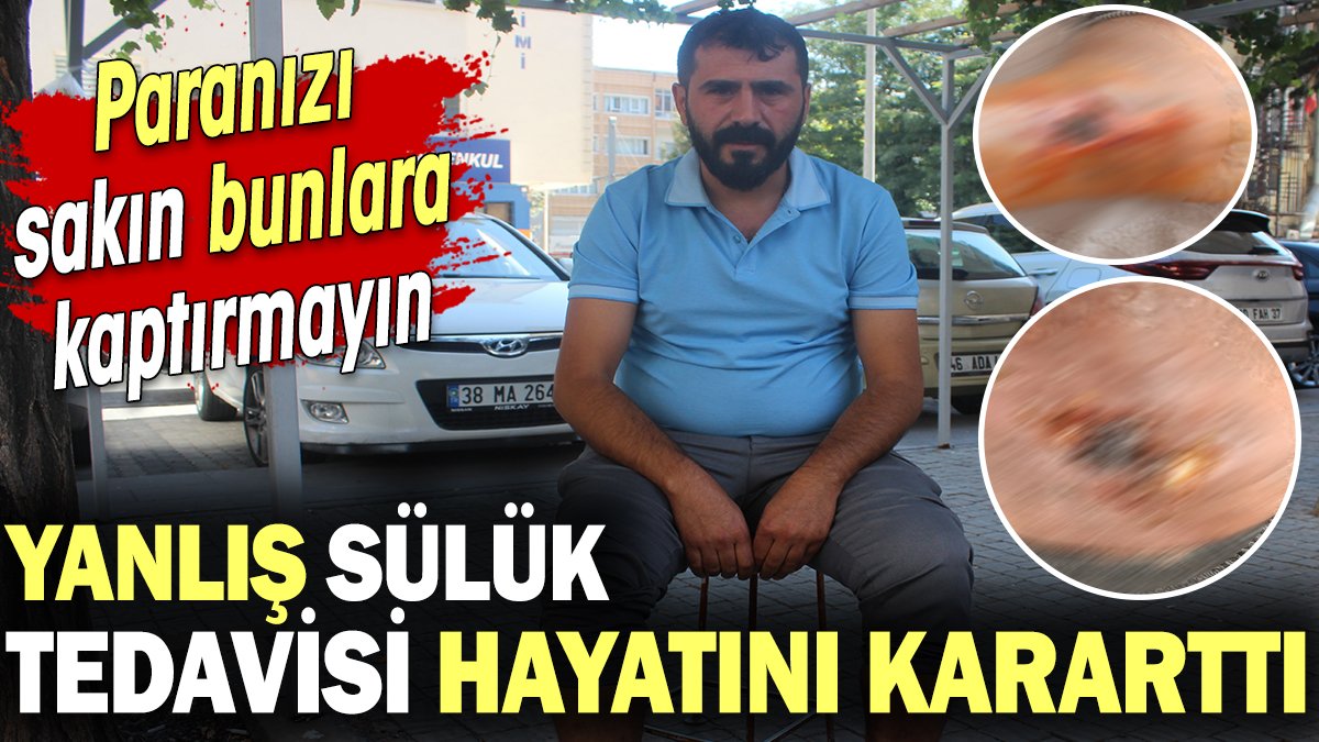 Yanlış sülük tedavisi hayatını kararttı! Paranızı sakın bunlara kaptırmayın