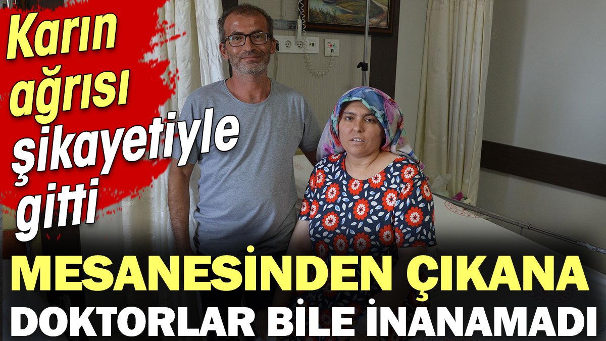 Mesanesinden çıkana doktorlar bile inanamadı. Karın ağrısı şikayetiyle gitti