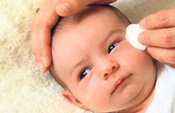 Bebeklerde çapaklanma bel soğukluğu işaretçisi olabilir
