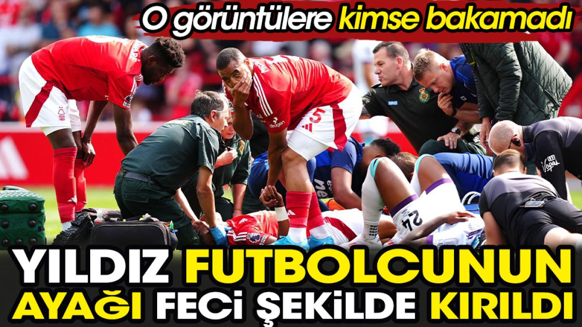 Yıldız futbolcunun ayağı feci şekilde kırıldı. O görüntülere kimse bakamadı