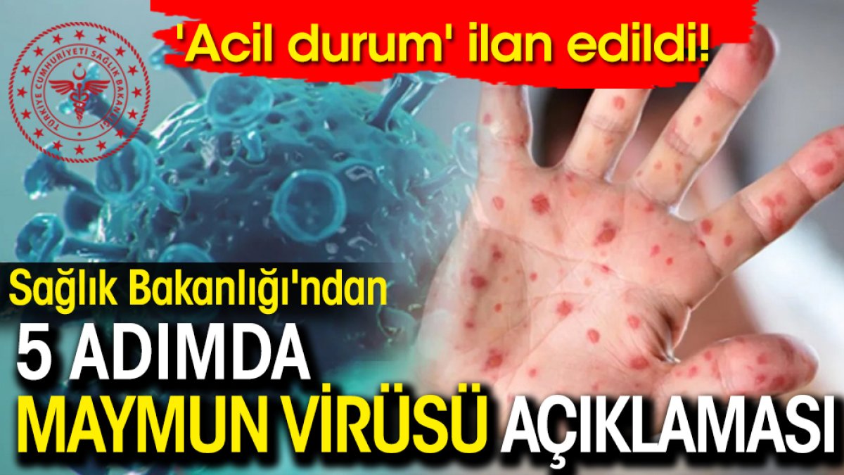 Sağlık Bakanlığı'ndan 5 adımda maymun virüsü açıklaması: 'Acil durum' olarak ilan edildi!