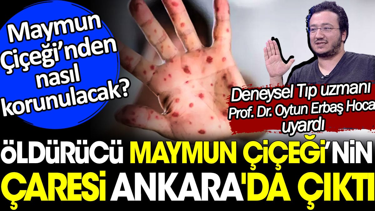 Öldürücü Maymun Çiçeği'nin çaresi Ankara'da çıktı. Prof. Dr. Oytun Erbaş açıkladı