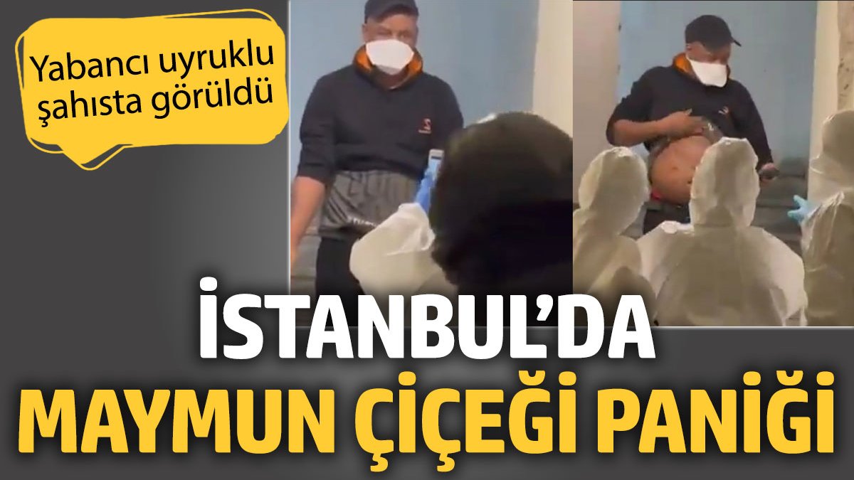 İstanbul Beyoğlu'nda maymun çiçeği paniği. Yabancı uyruklu şahısta görüldü