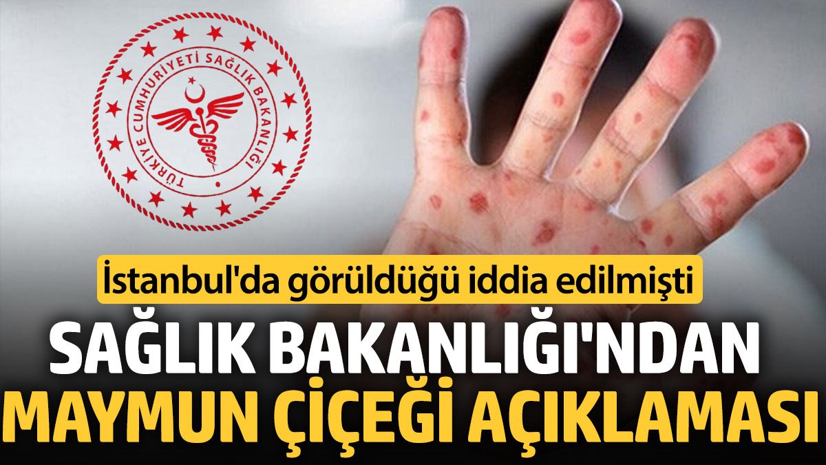 Sağlık Bakanlığı'ndan Maymun Çiçeği vakası açıklaması