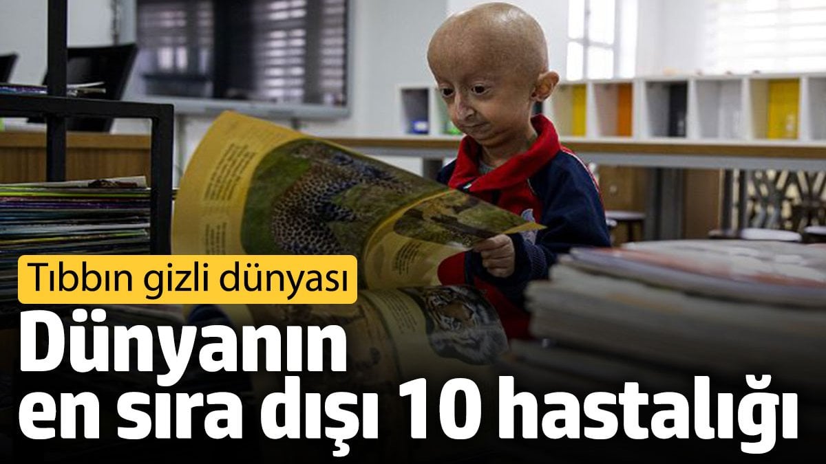 Dünyanın En Sıra Dışı 10 Hastalığı: Tıbbın Gizli Dünyası