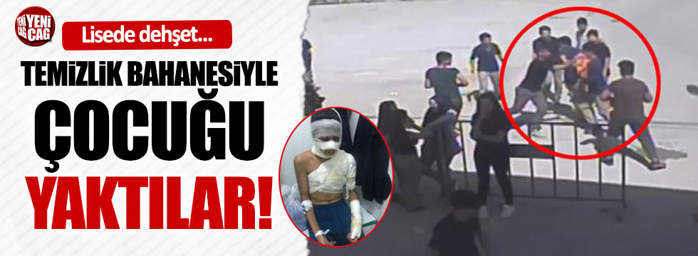 Bursa'da bir lise öğrencisi böyle yandı