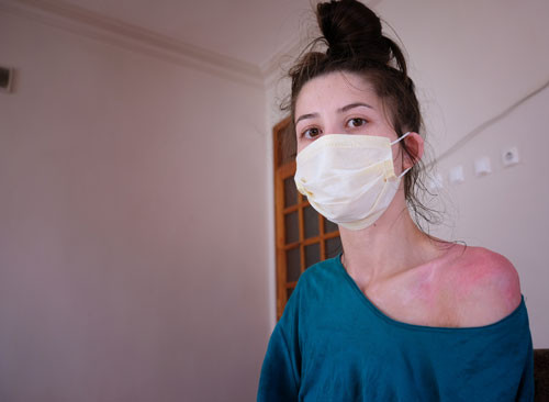 Sıcak su silah sayıldı. Konya'da karısını ve kızını haşlamıştı - Resim : 8