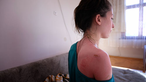 Sıcak su silah sayıldı. Konya'da karısını ve kızını haşlamıştı - Resim : 6