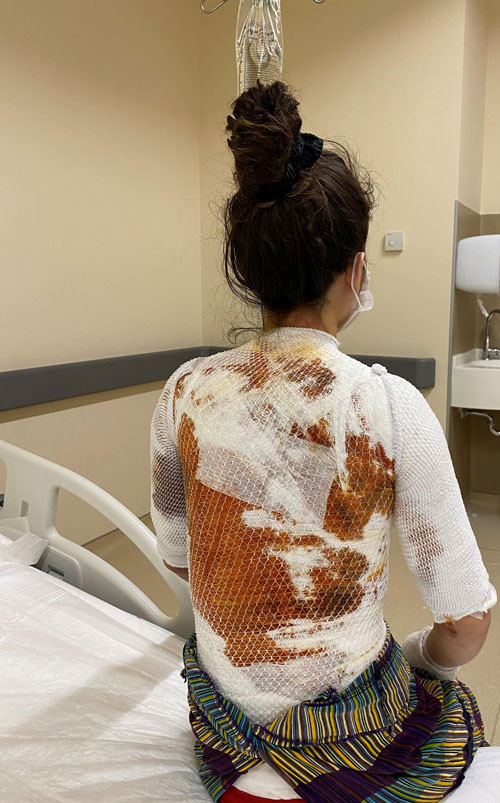 Sıcak su silah sayıldı. Konya'da karısını ve kızını haşlamıştı - Resim : 3