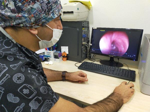 Endoskopi yapan doktor akciğerin içinde gördü gözlerine inanamadı - Resim : 4