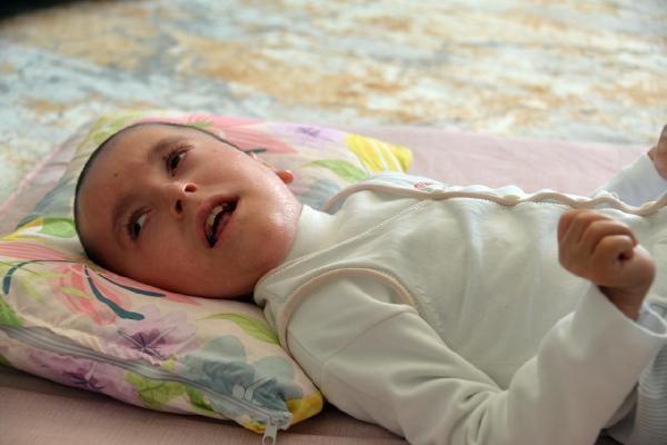 Bir babanın evladı için yürek yakan isteği. Doktorlar 2 yıl ömür biçti - Resim : 4