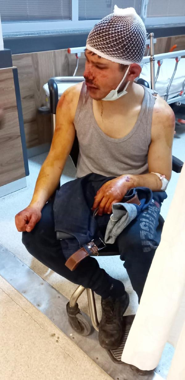 Afyonkarahisar'da dayakçı patron tutuklandı. 16 yaşındaki çocuğa işkence etmişti - Resim : 2